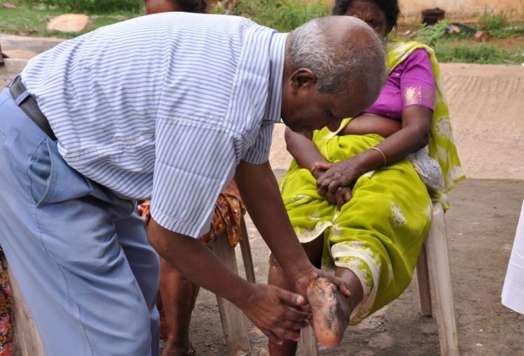 Patients with leprosy often need ongoing treatment to help them manage their disease.